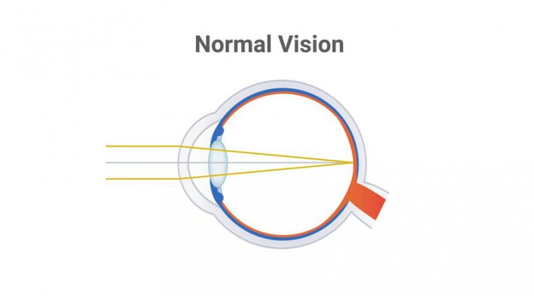 Emmetropic Eyes: The Gold Standard of Vision