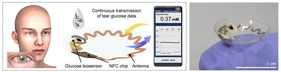 A schematic and image of the smart contact lens developed by the joint research team