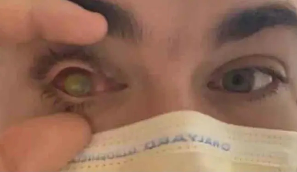 picture of man lost vision in one eye