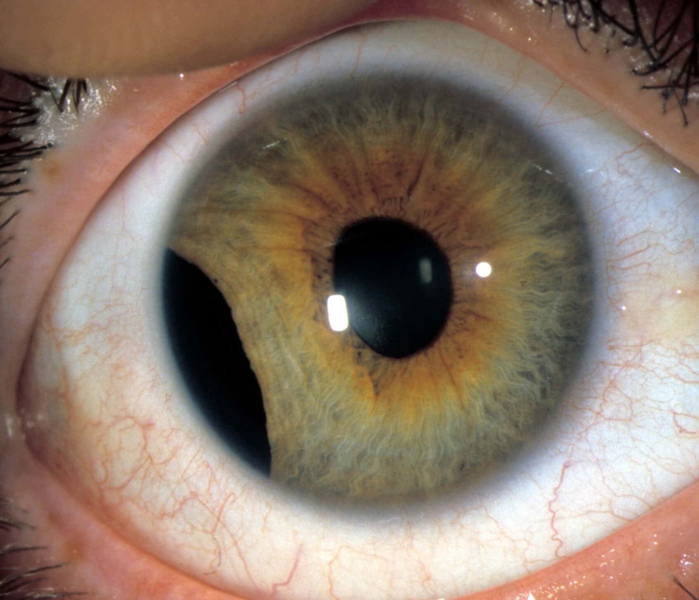 close-up picture of an eye