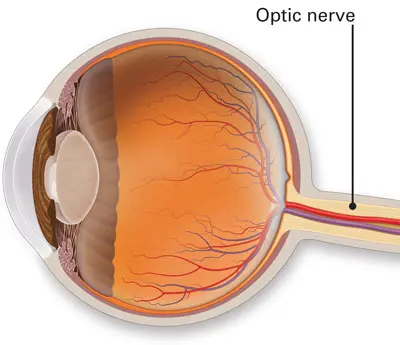 a visual giving informaion on optic nerve