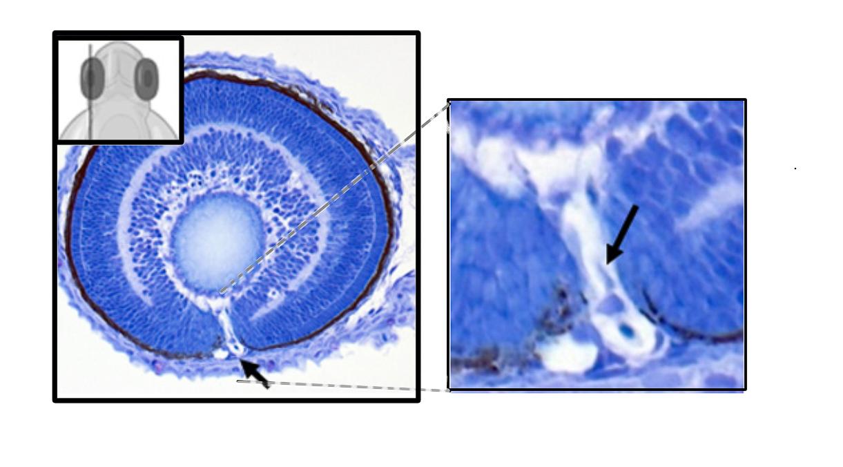 Cross section of an embryonic rerea mutant zebrafish eye showing coloboma. In normal zebrafish, the optic fissure closes
