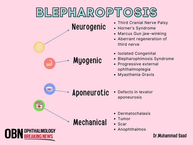 a graphic giving details about blepharoptosis
