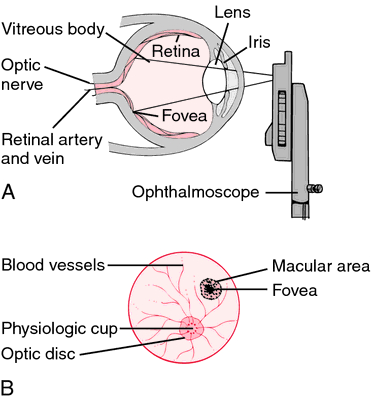 a visual giving informaion on ophthalmoscope and the eye