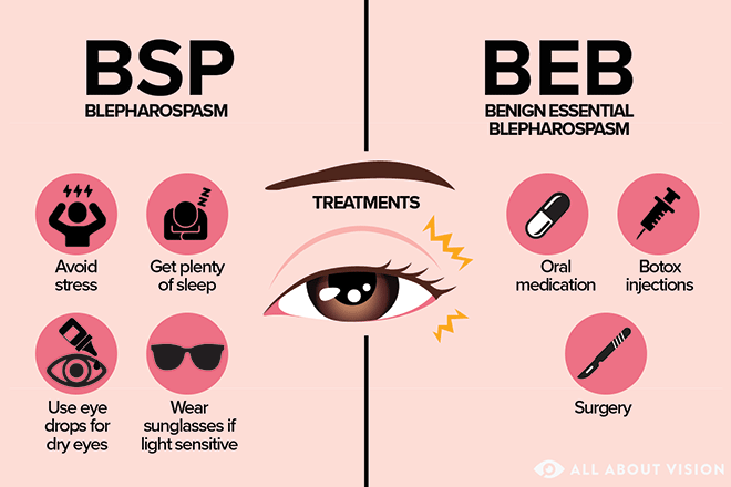 Treatment options