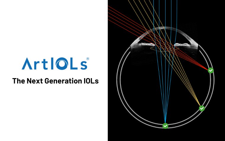 ArtIOLs®: First Inverted Meniscus Optics IOLs delivering Superior Peripheral Vision