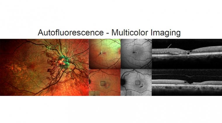 Autofluorescence - Multicolor Imaging