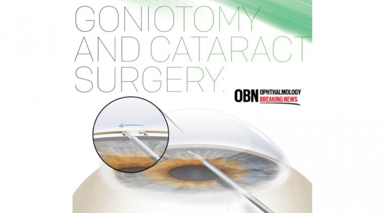 Cataract Surgery & Goniotomy