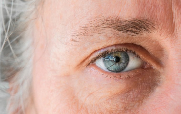 Can Antidepressant Use Increase the Risk of Glaucoma?