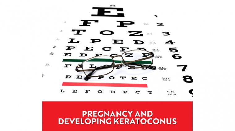 Effects of Pregnancy on Keratoconus