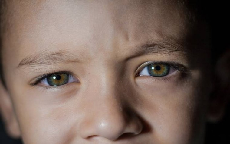 Eye Ultrasound Proves Effective for Pediatric Brain Shunt Failures