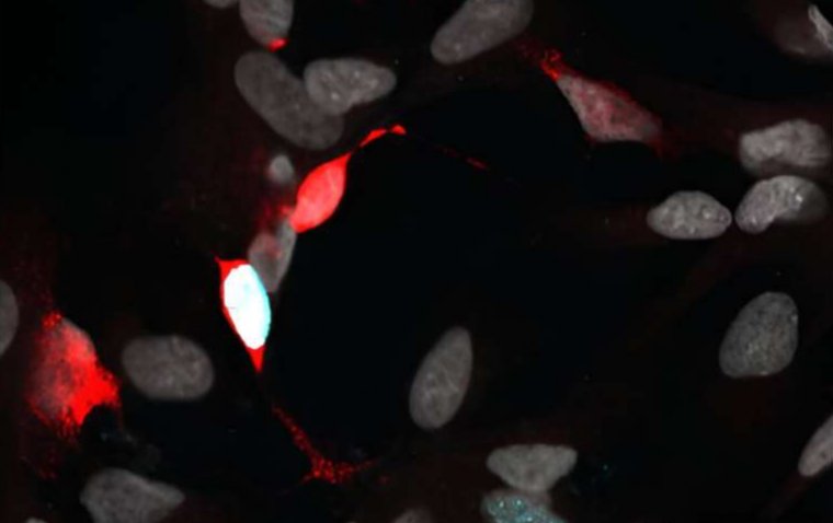 Fish-Like Genetic Program Transforms Human Retinal Cells into Neurons