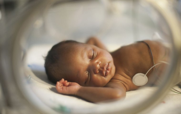 G-CSF's Therapeutic Potential Explored in Premature Infants' Lung and Eye Health
