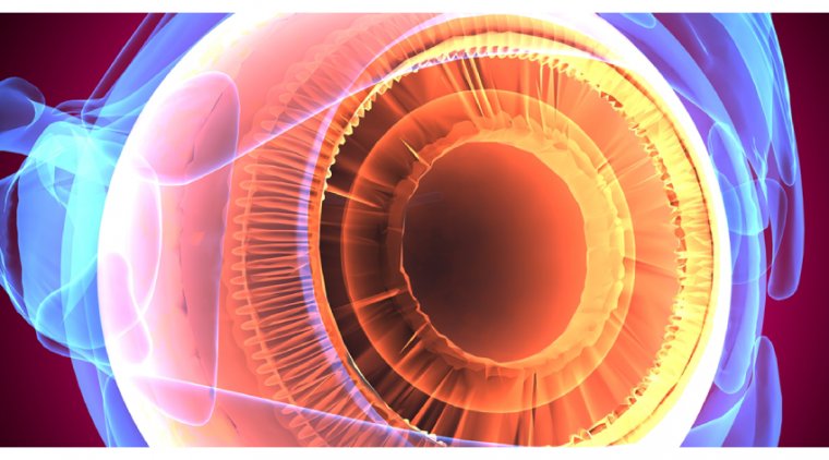 Genetic Risk Linked to Rapid Visual Field Worsening in Glaucoma 