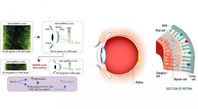 How to Repair the Optic Nerve Through Removing a Membrane 