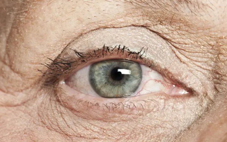 How Your Eyes Evolve over Time and What You Can Do