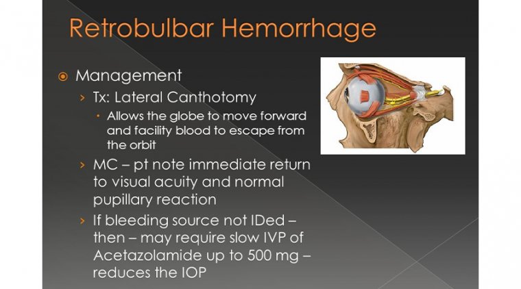 In Light Of  Managing Retrobulbar Hemorrhage