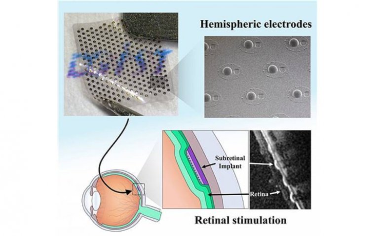 Innovative 3D Retinal Electrodes Developed to Restore Vision in Blind Patients