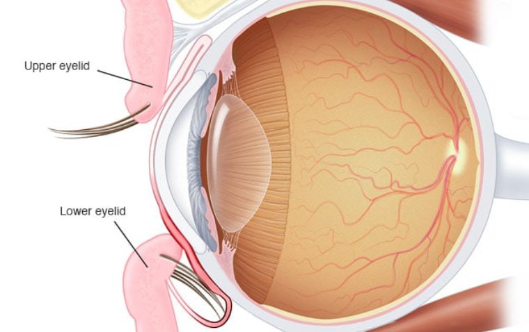 Inward Turning Eyelids: A Comprehensive Guide to Entropion