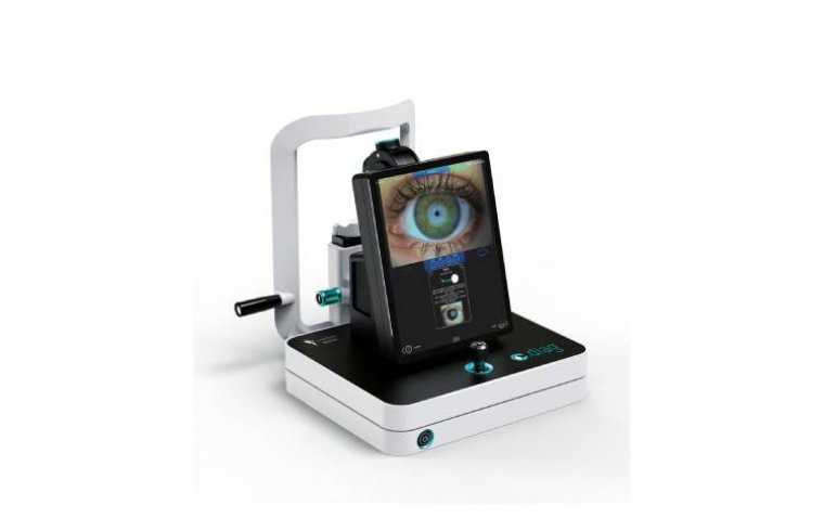 Lumibird Introduces C.DIAG: Novel Dry Eye Diagnostic Aid Platform