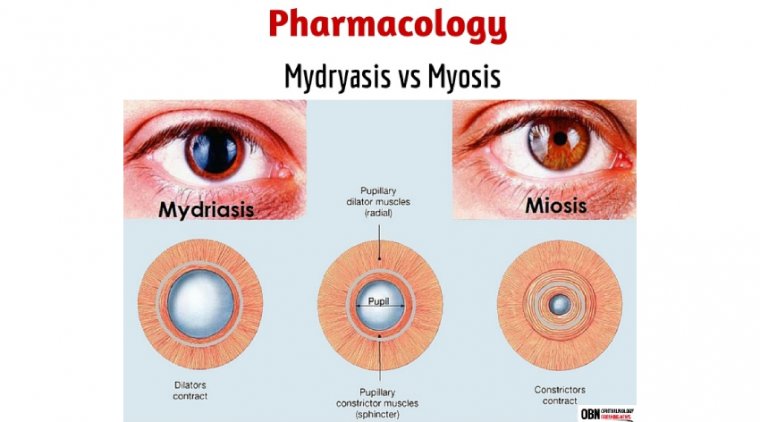 Management of Mydriasis in Cataract - IOL Surgery