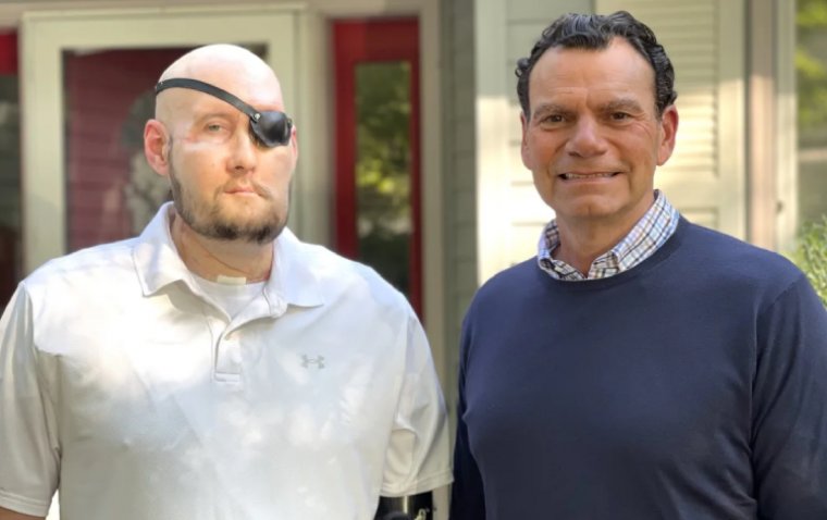 Medical Breakthrough: World’s First Whole-eye and Partial Face Transplant 