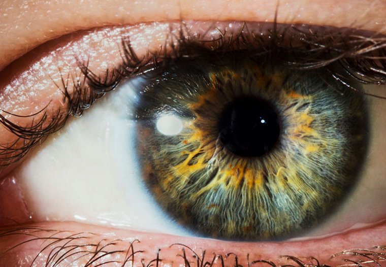 New Deep-Learning Resource Model Can Identify Many Common Eye Diseases