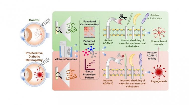 New Treatment For Diabetic Retinopathy Treatment OBN