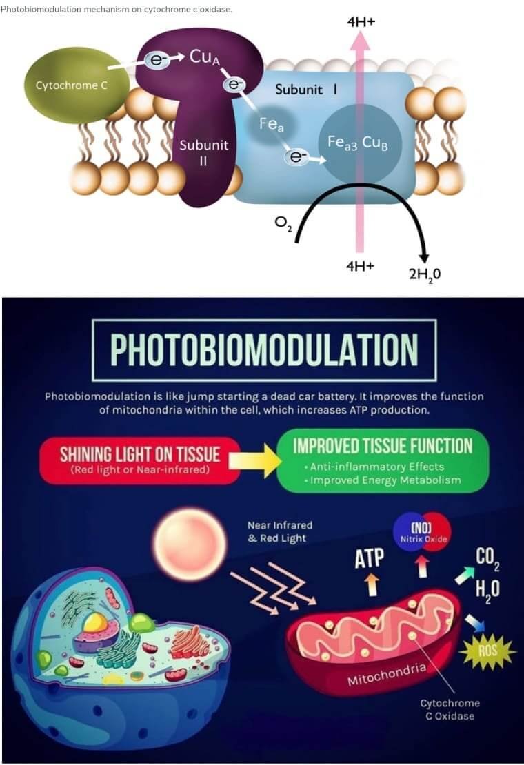 Photobiomodulation & Dry AMD Treatment