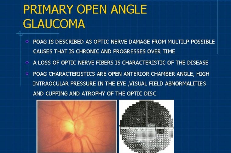 Primary Open Angle Glaucoma (POAG) 