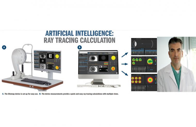 Ray Tracing Optimization – Myopic LASIK & Artificial Intelligence