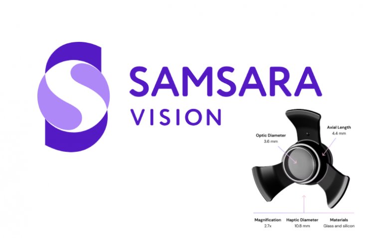 Samsara's Implantable Telescope Restores Vision in UK Patients with Late-Stage AMD