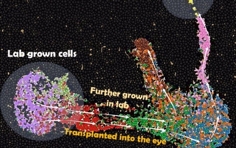 Scientists Uncover Promising Pathway for AMD Treatment 