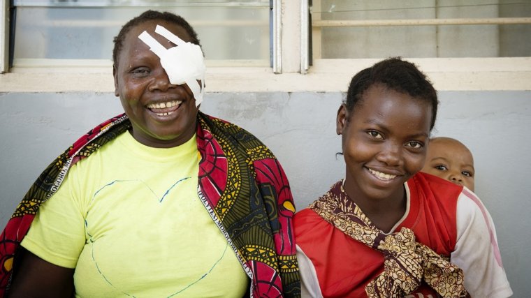Sightsavers’ Eye Health Project Transforms Lives of Thousands in Tanzania 