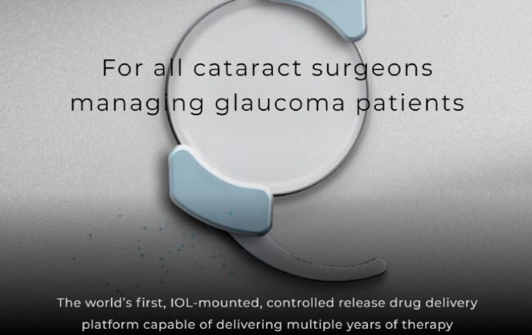 SpyGlass Pharma Secures $90M Financing to Advance Novel Treatments for Glaucoma