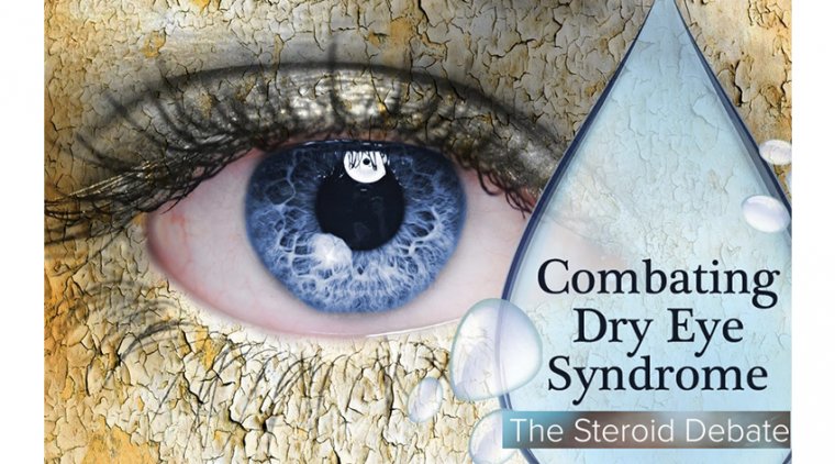 Steroid Treatment For Dry Eye Disease