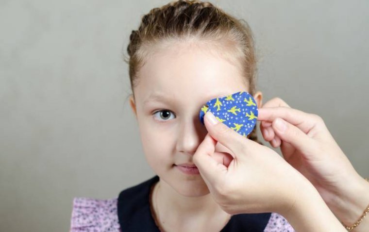 Study Finds Continued Patching After Age 4 Offers Limited Visual Benefit in Children with Unilateral Congenital Cataract
