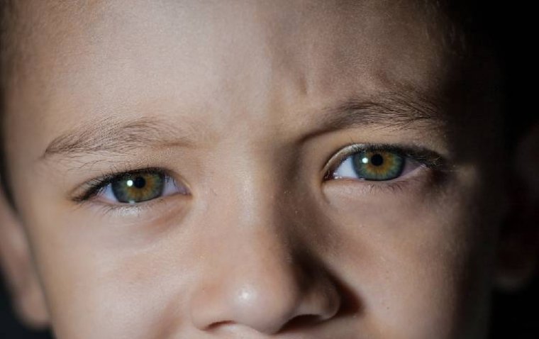 Study Identifies Novel Retinal Disorder Linked to Sudden Vision Loss in Children