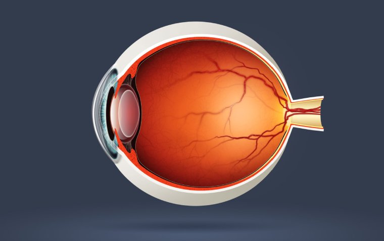 Study Links Socioeconomic Deprivation to Severity of Rhegmatogenous Retinal Detachment