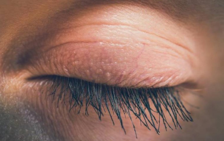 Study Reveals Complex Muscle Patterns Behind Blinking and Eyelid Movement