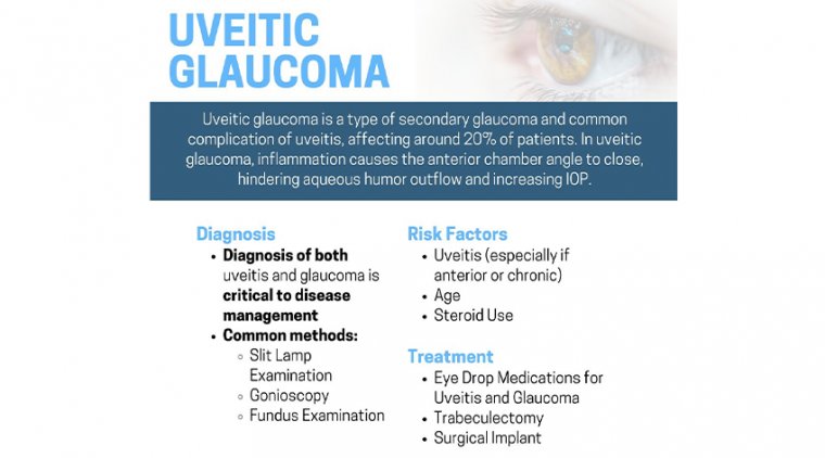 The Link Between Glaucoma & Uveitis