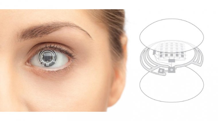 Therapeutic Contact Lenses Market Projected to Reach New Heights by 2033