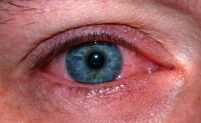 close up picture of a blue eye