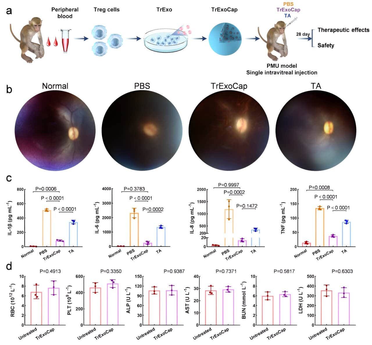 Therapeutic effects of TrExoCap in a PMU nonhuman primate model. Credit: Bao Han and Tian Ying