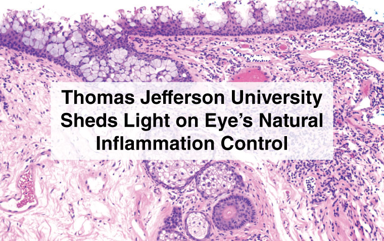 Researchers Discover New Role of Immune Cells in Eye Health