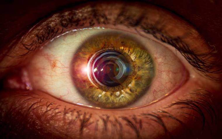 New Drug Targets Identified for Treating Inherited Retinal Degenerations